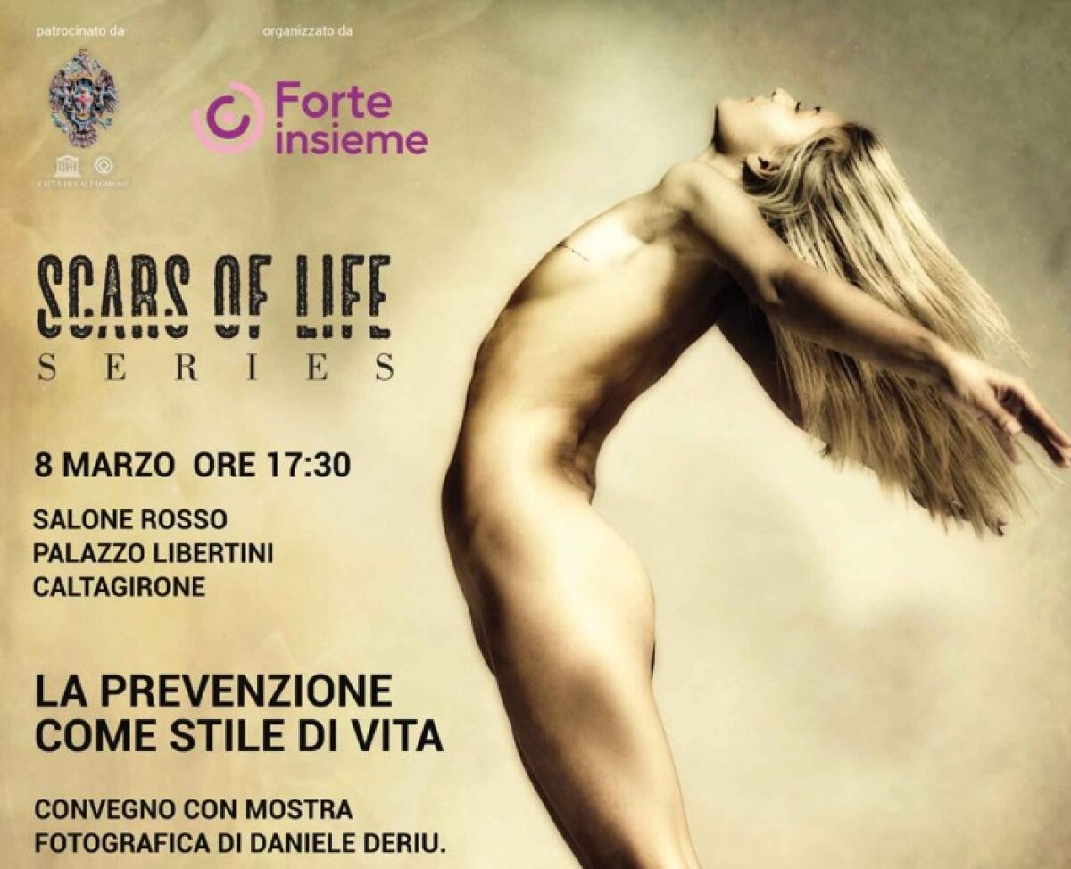 Caltagirone: giovedì 8 marzo l'associazione Forte Insieme organizza il convegno e la mostra "Scars of Life" - 